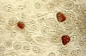Klamidya (bakteri)