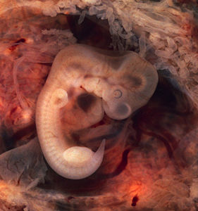 embriyonik
