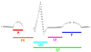 elektrokardiyogram