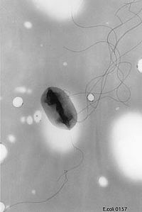 E. coli 0157 H7