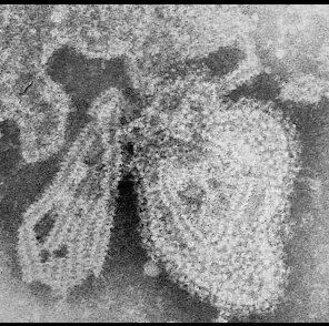 Kabakulak virüsü