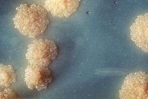 Mycobacterium tuberculosys