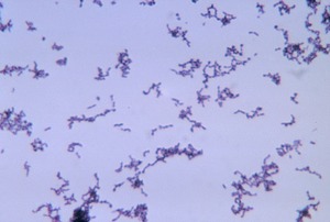 Propionibacterium aknesi
