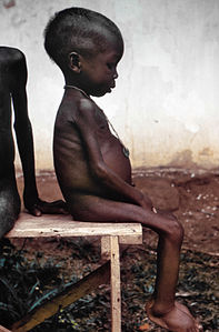 Afrika'daki açlık