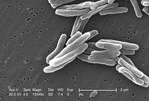 Tuberculosis bacillus