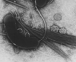 Vibrio cholera
