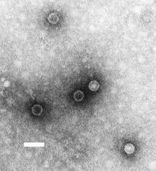 Poliovirüs